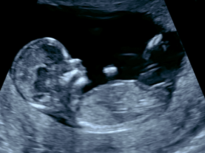 Échographie bienveillante pour des moments précieux de maternité et santé féminine.