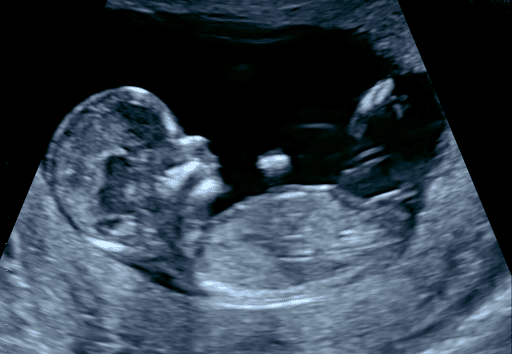 Échographie bienveillante pour des moments précieux de maternité et santé féminine.