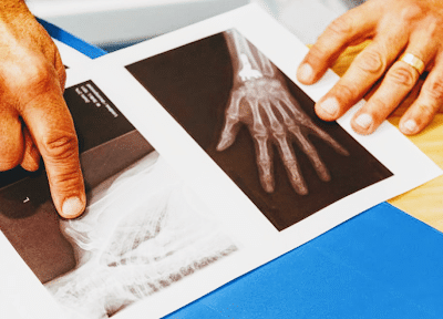 Révélez votre bien-être avec l'ostéopathie et kinésithérapie